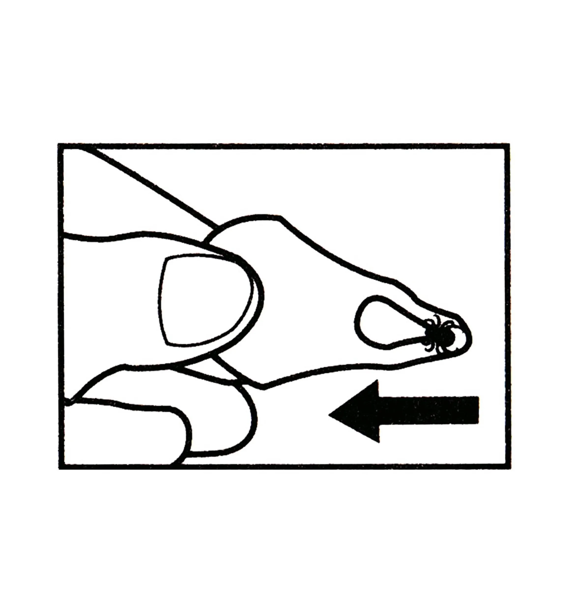 Lee Valley Pest Control>Set Of 3 Tick Key Tick Removers